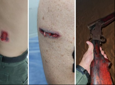 Policiais foram atingidos de raspão no braço e nas costas, e estão fora de perigo; suspeito foi preso junto com arma do crime 
