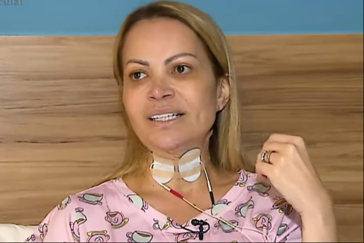 Solange Almeida revelou lesões em suas cordas vocais devido ao vício em cigarros eletrônicos