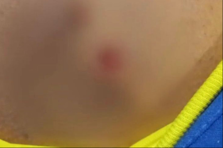 Motorista da linha 026, Antônio Bezerra Messejana, leva tiro de raspão dentro do coletivo