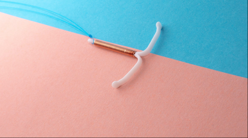 O procedimento para inserir o dispositivo intrauterino (DIU) é rápido, mas envolve um grau de desconforto que varia muito de mulher para mulher; saiba mais sobre o método contraceptivo