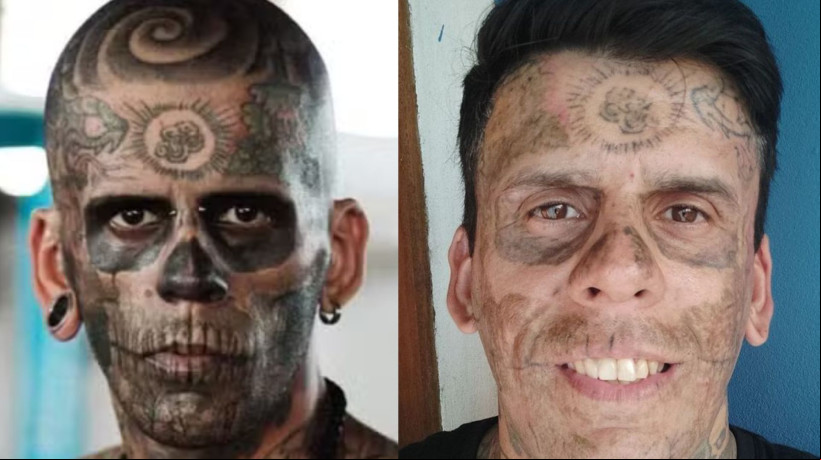 A conversão ao cristianismo, que ocorreu há pouco mais de um ano, foi o ponto de partida para a remoção das tatuagens.