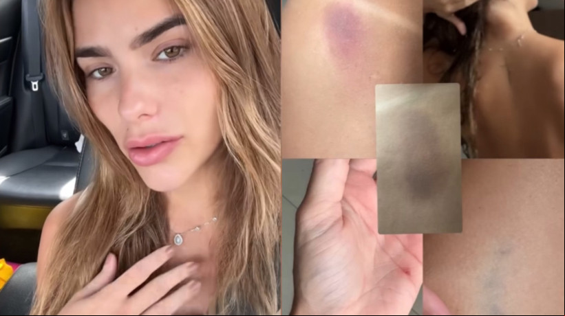 Modelo cearense publicou denúncia da agressão nas redes sociais