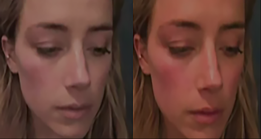 Amber apresentou uma foto com rosto vermelho após suposta agressão do marido. Mas a defesa de Depp comparou com outra fotografia da mesma ocasião, em que o rosto estava mais claro. E um especialista testemunhou dizendo que teria havido edição na foto levada pela defesa da atriz.